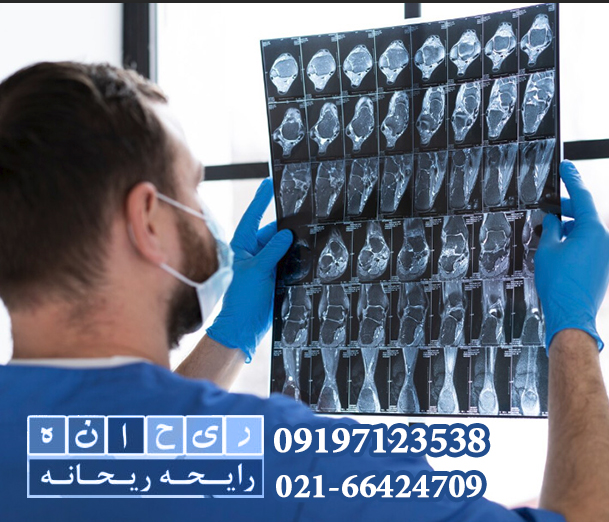 چاپ انواع تصاویر پزشکی رایحه ریحانه 