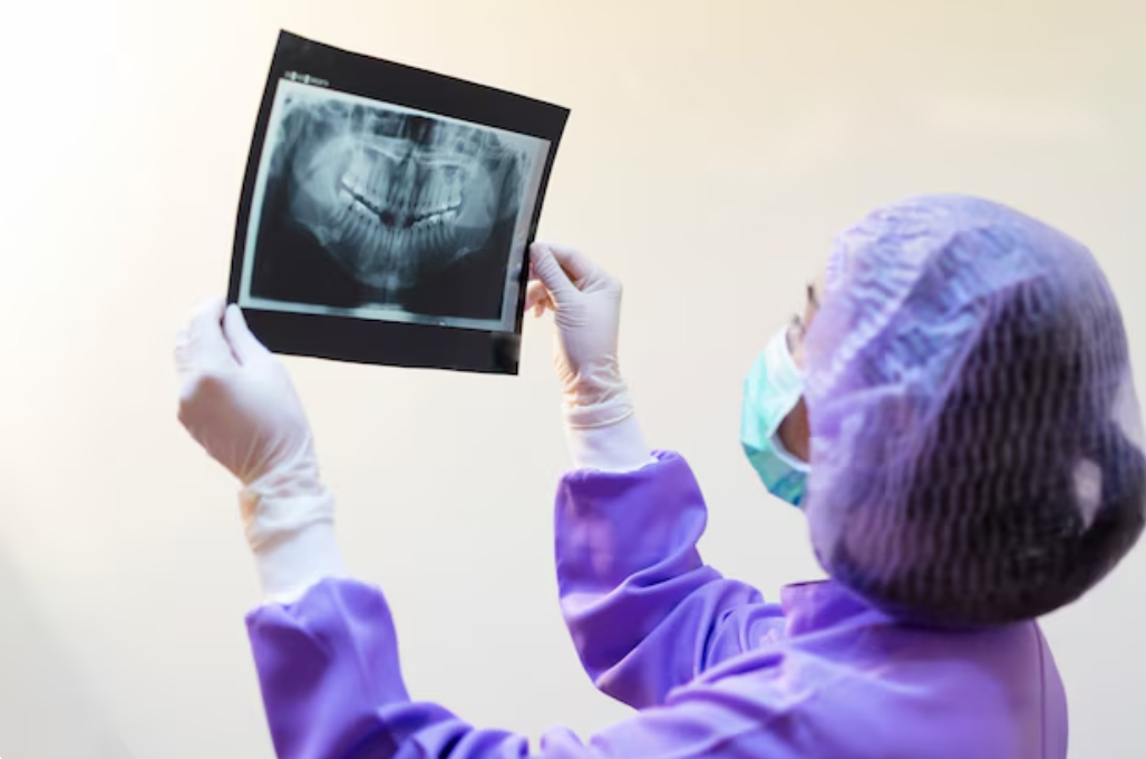 کلیشه opg دندان رایحه ریحانه 